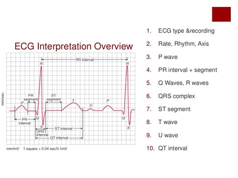 borderline ecg|How to interpret the ECG: A systematic approach.